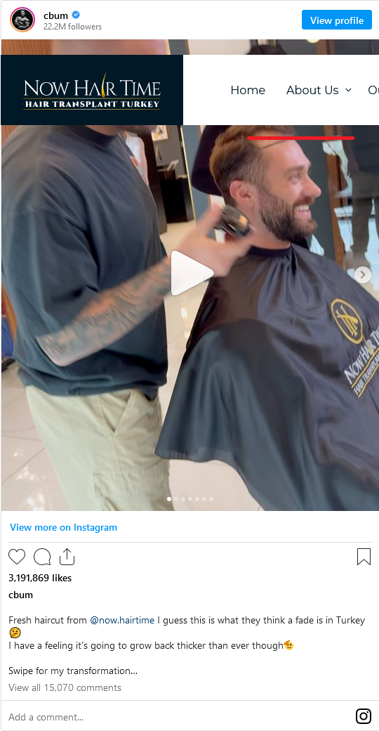 Screenshot 2023-12-12 at 19-01-40 Chris Bumstead got hair transplant in Now Hair Time 2.png