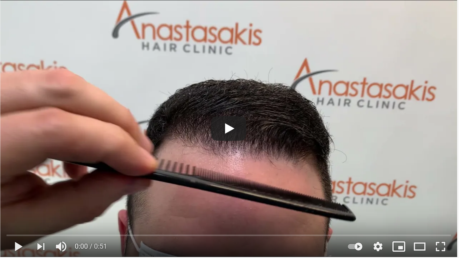 Screenshot_2021-04-01 Hairlossgr forum - Αποτέλεσμα 10 μηνών (με βρεγμένο μαλλί).png