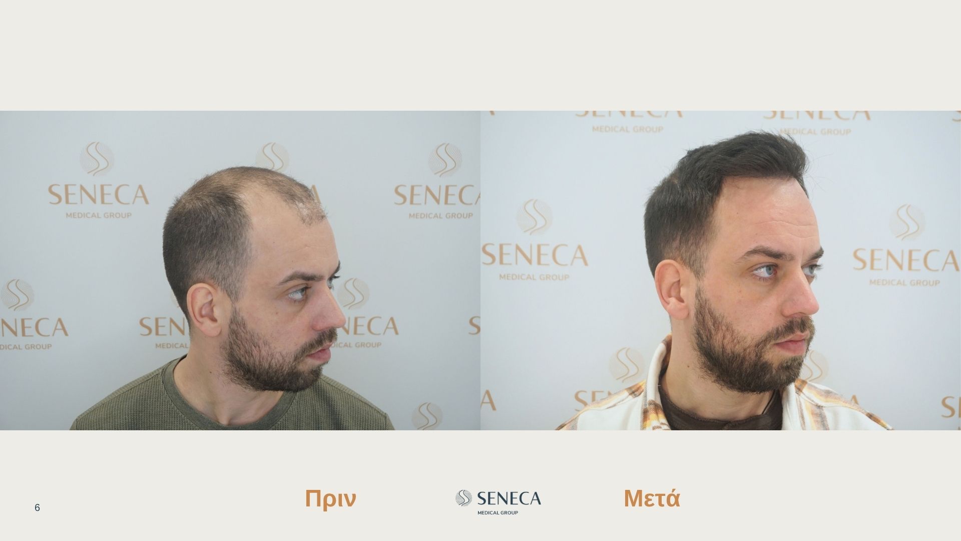 Seneca-presentation-FORUM Filipopoylos El.pptx (4).jpg