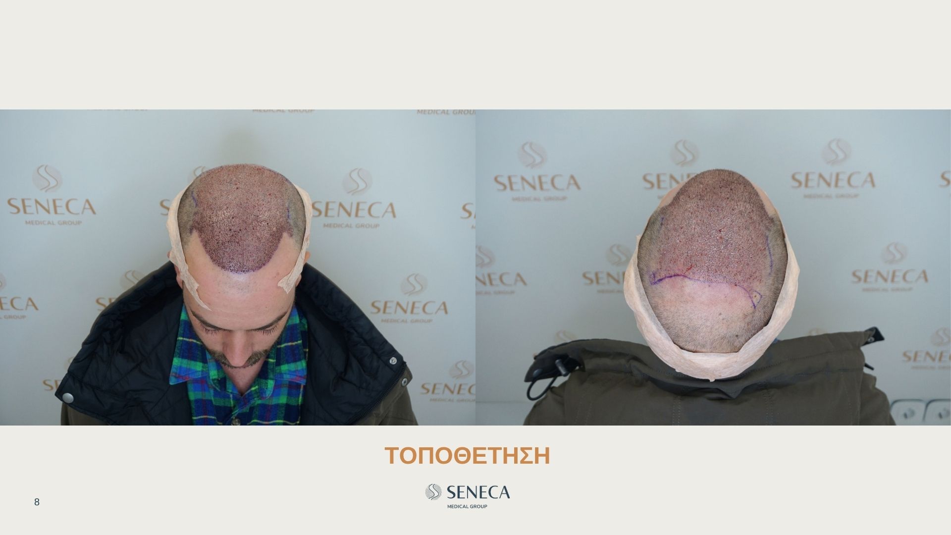 Seneca-presentation-FORUM Filipopoylos El.pptx (6).jpg