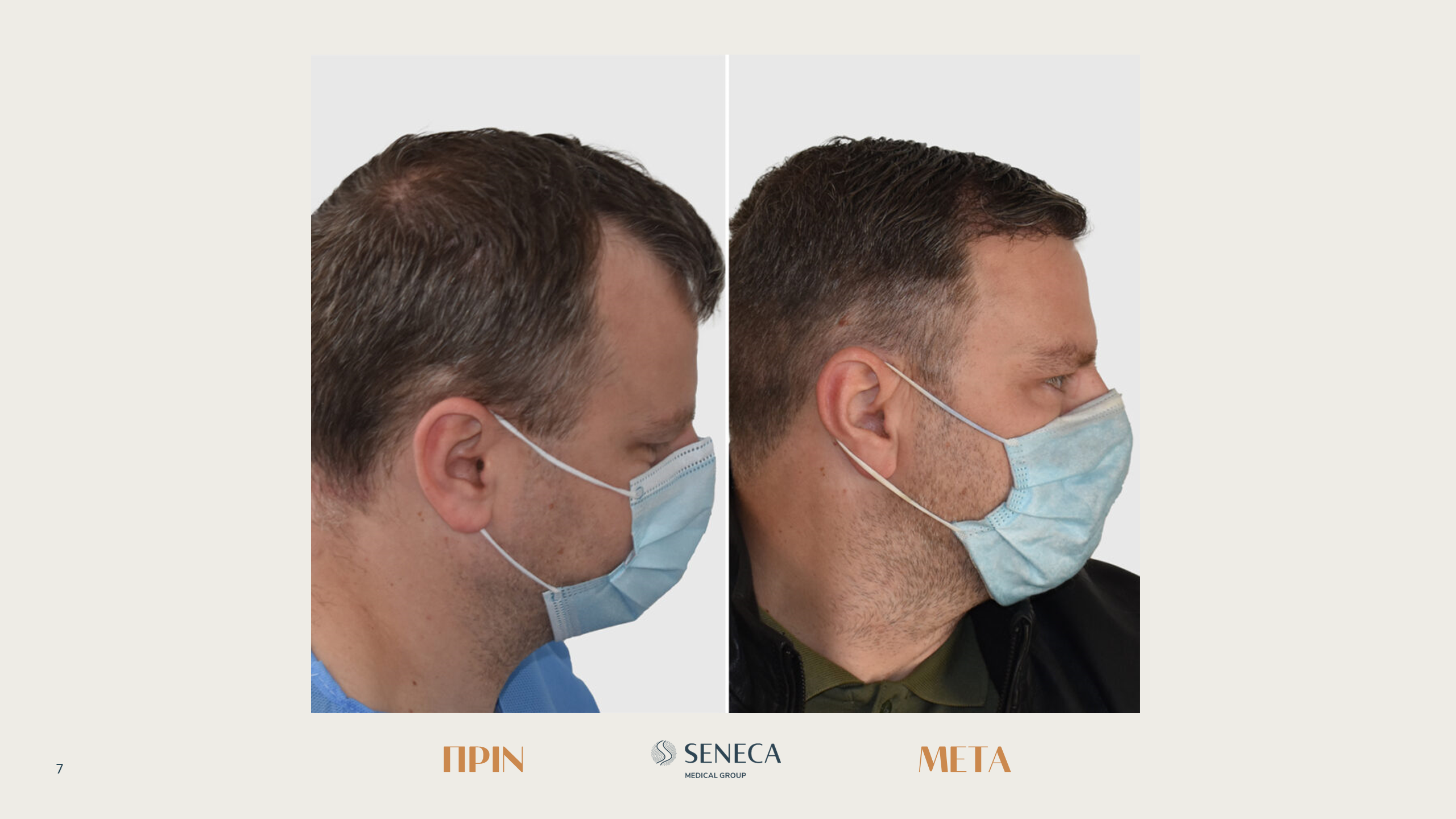 Seneca-presentation-FORUM L_Richard GR.png