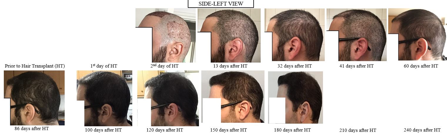 side-left_view.JPG