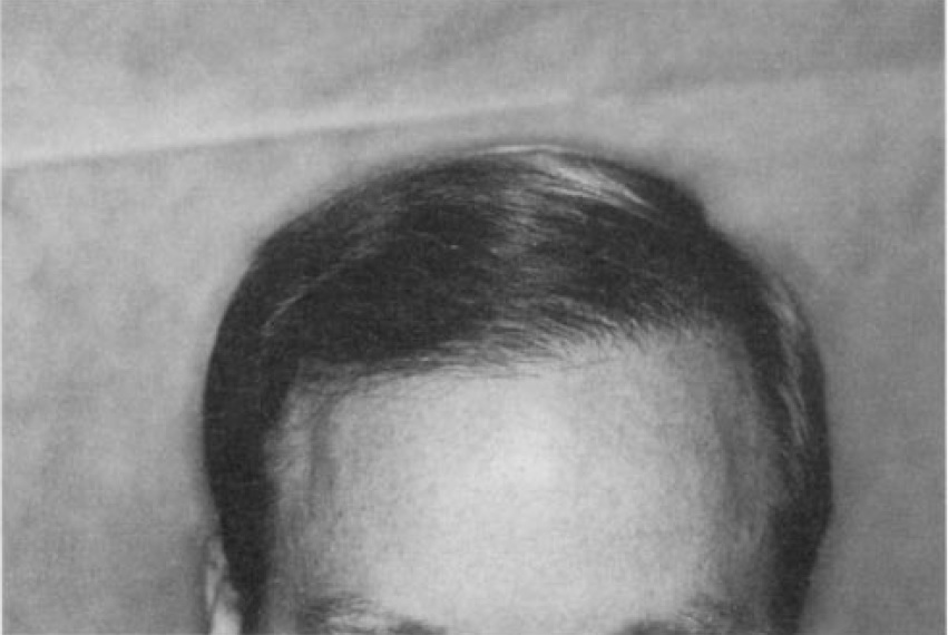 side weighting 1.jpg