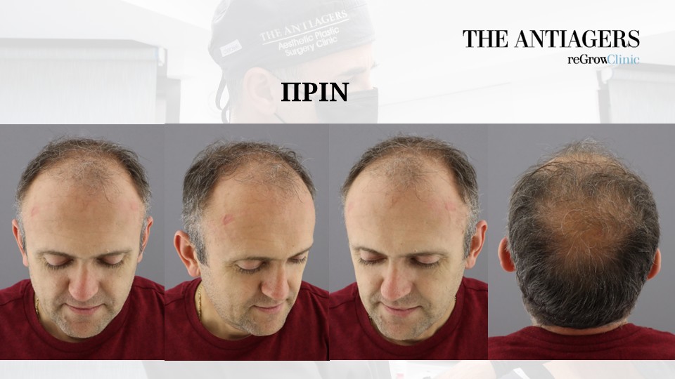 Slide3.JPG