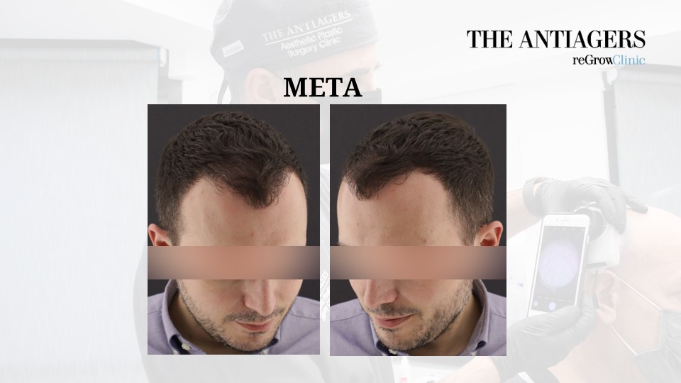 Slide5.JPG