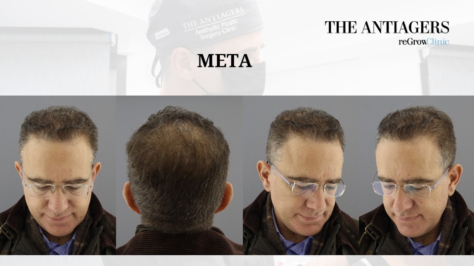 Slide5.JPG