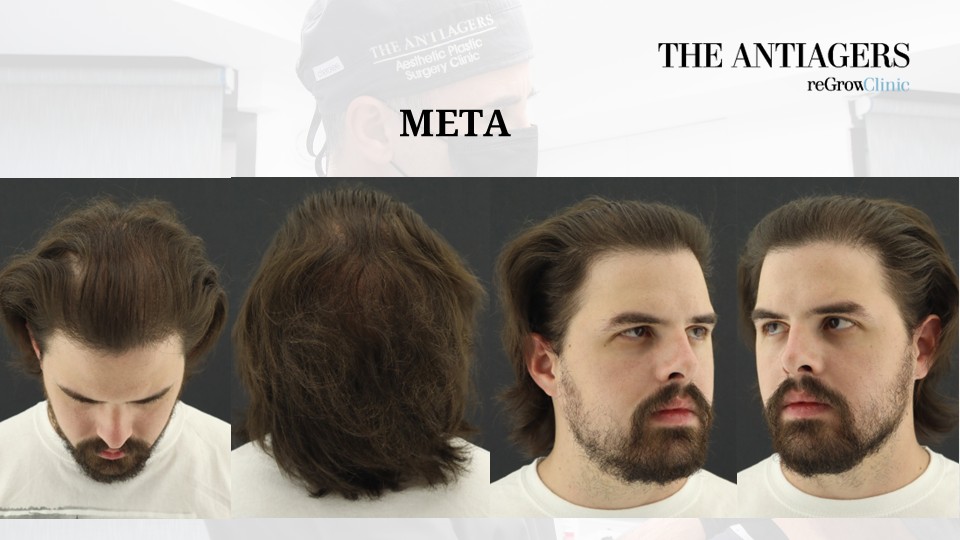 Slide5.JPG