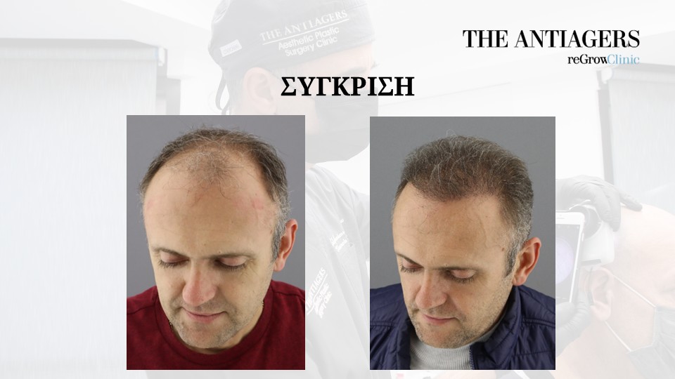 Slide8.JPG