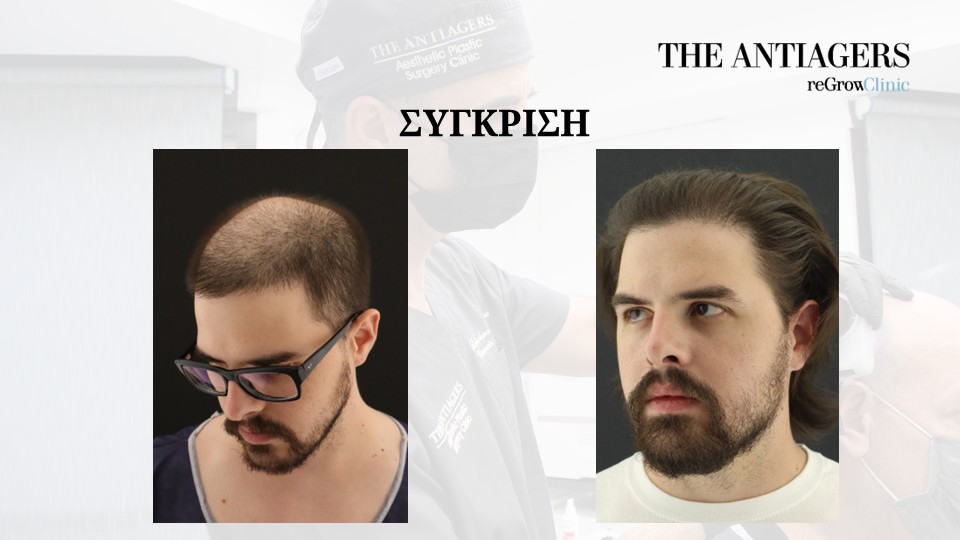 Slide8.JPG