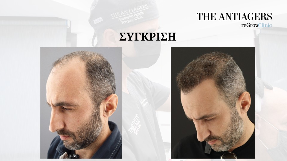 Slide8.JPG