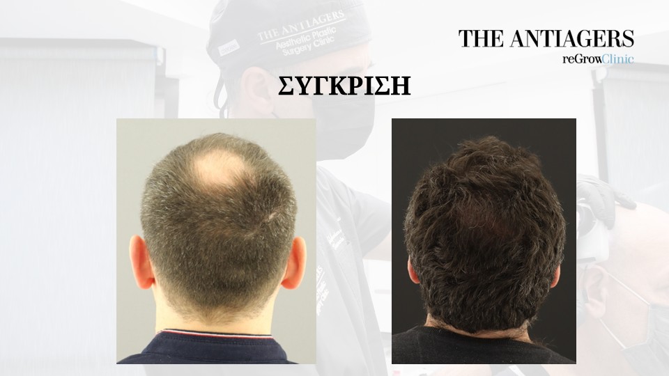 Slide9.JPG
