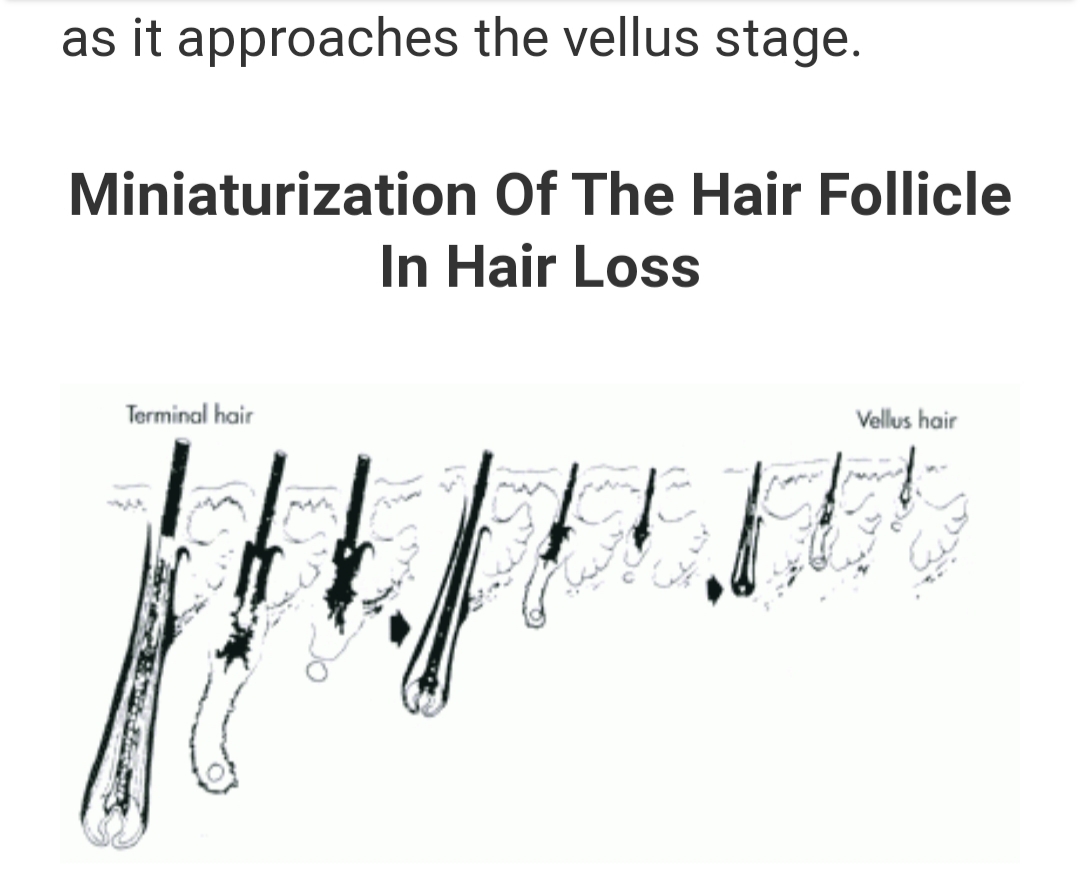 velus hair.jpg