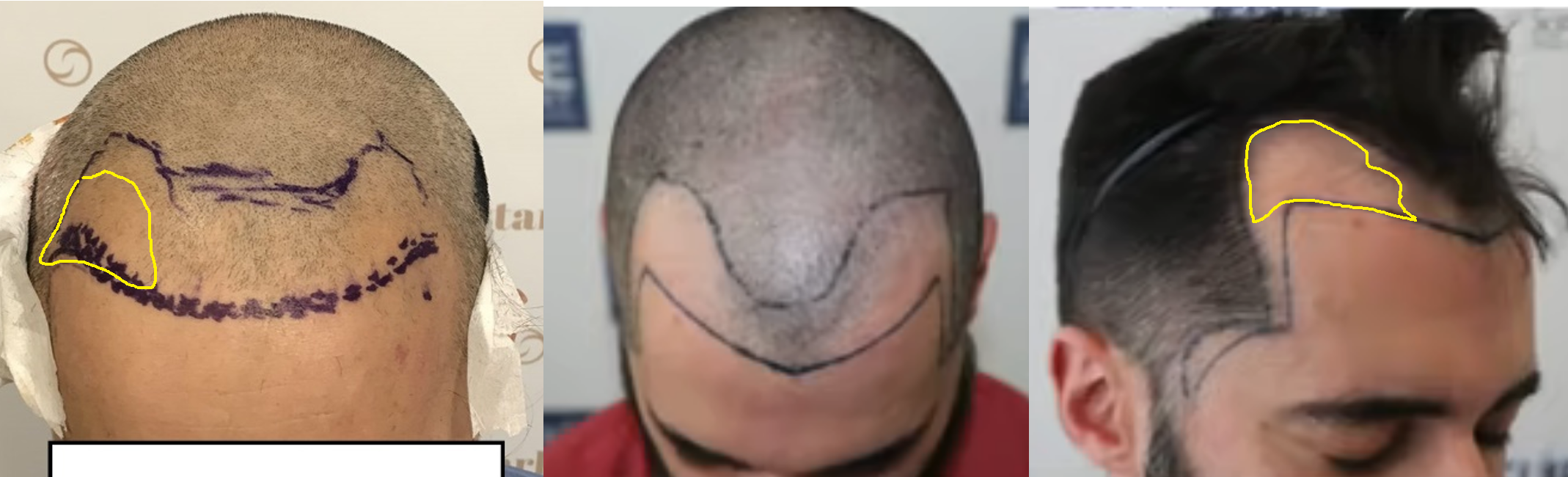 vlafo cuto rev.png