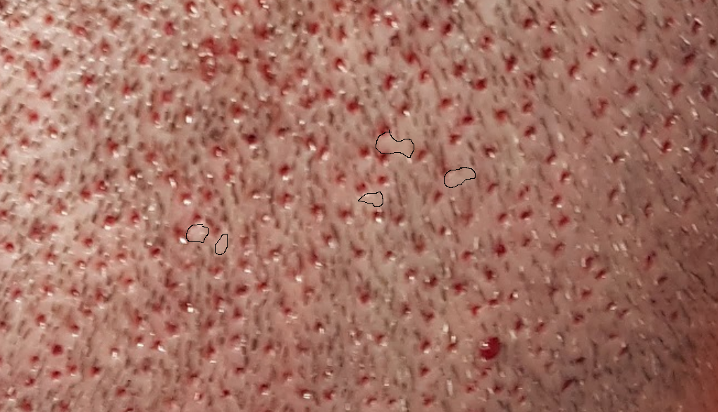 whiite dots.png