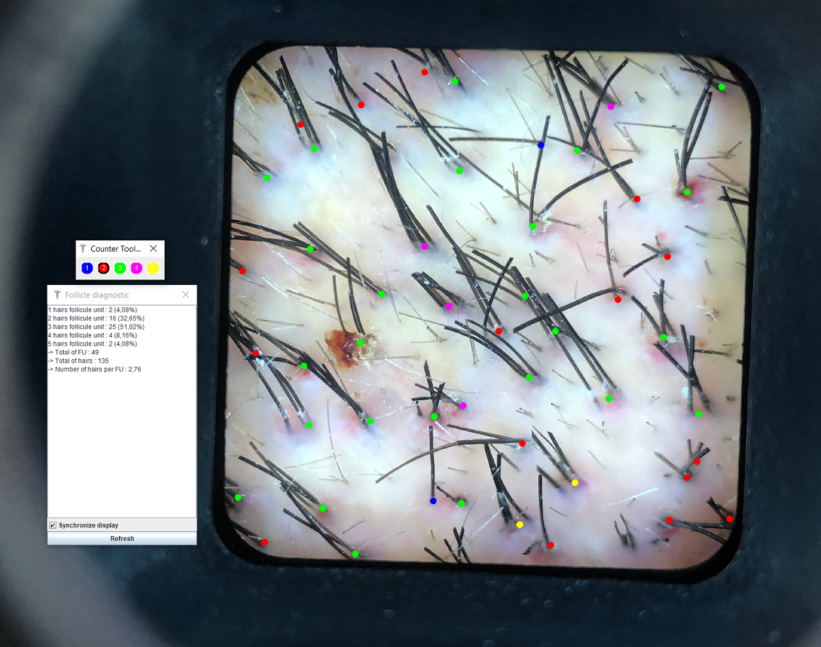 xristos97 A zone density 3.png