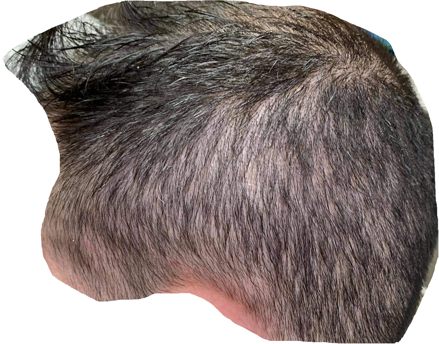 zimia1.jpg