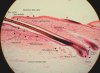hair_follicle_100x_labeled.jpg