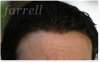 10484452-farrell-hair-australia-understands-your-hair-loss.jpg