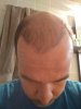 IMG_20180203_134518.jpg