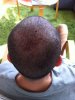 postop4.jpg