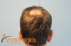 3220-back1-before.jpg