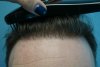 CASE#1-hairline.jpg