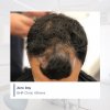 IMG-before.jpg IMG-before.jpg