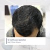 IMG-after.jpg IMG-after.jpg