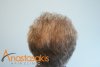 crown-after.jpg