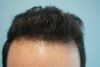 hairline1.JPG