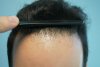 hairline2.JPG