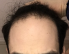long-dry_6.png