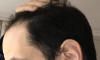 long-dry_5.png