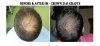 Before and After 5 Months - Crown.jpg