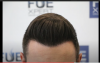 hairline.png