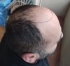 Inkedprofil deks_LI.jpg Inkedprofil deks_LI.jpg