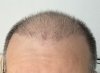Hope 3 months_a.JPG