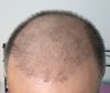 Hope 3 months_b.JPG