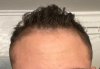 hair-3.JPG hair-3.JPG