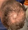 hair-4.JPG hair-4.JPG