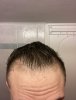 hair-9.jpg hair-9.jpg