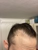 hair-10.jpg hair-10.jpg