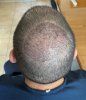 12 days after - Crown.jpg