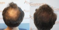 before-after_low.jpg