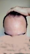 hairline 2.jpg