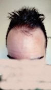 hairline 4.jpg