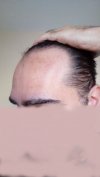 hairline5.jpg