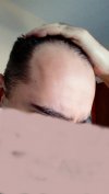 hairline6.jpg