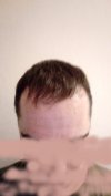 hairline front 4.jpg