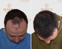 before-after4.jpg